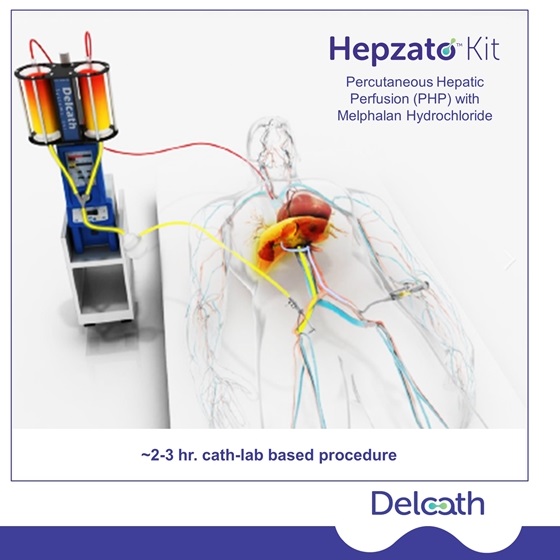 Hepzato Kit(melphalan)治疗葡萄膜黑色素瘤中文说明书-价格-适应症-不良反应及注意事项_香港济民药业