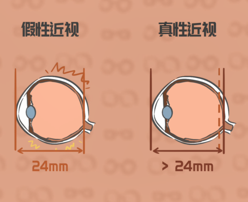 假性近视有哪些表现？使用善瞳滴眼液能改善儿童近视_香港济民药业