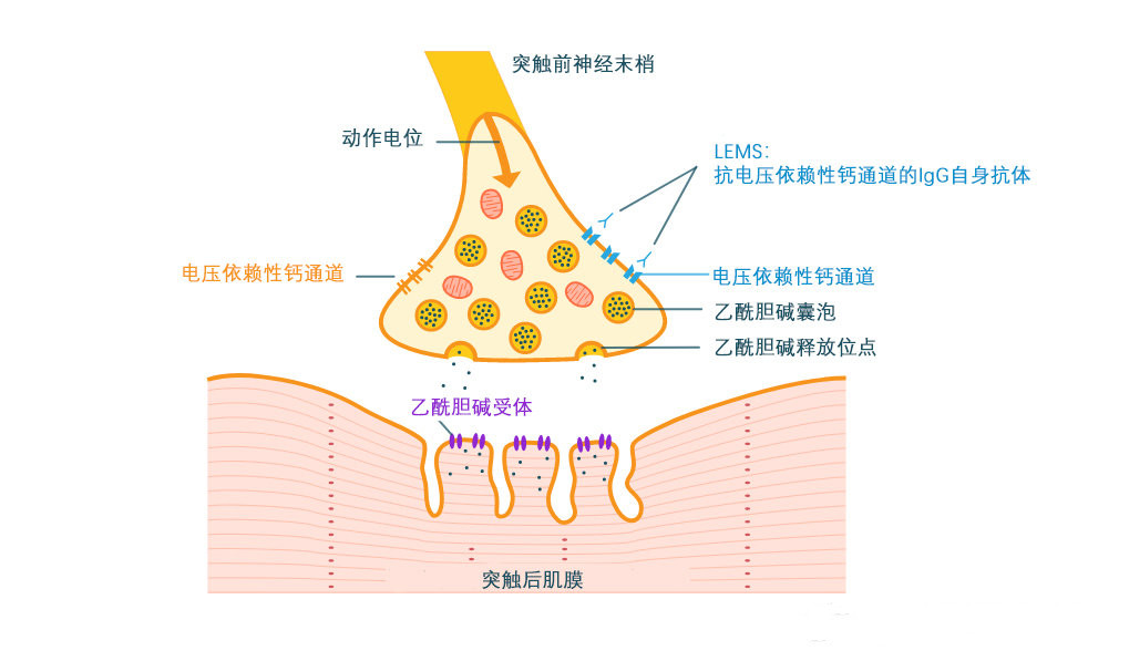 Lambert-Eaton肌无力综合征首个对症治疗药物：Firdapse(阿米吡啶)_香港济民药业