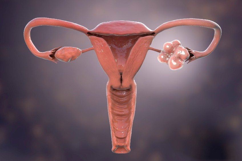 FDA优先审查Elahere在耐铂卵巢癌中的验证数据，有望获得完全批准_香港济民药业