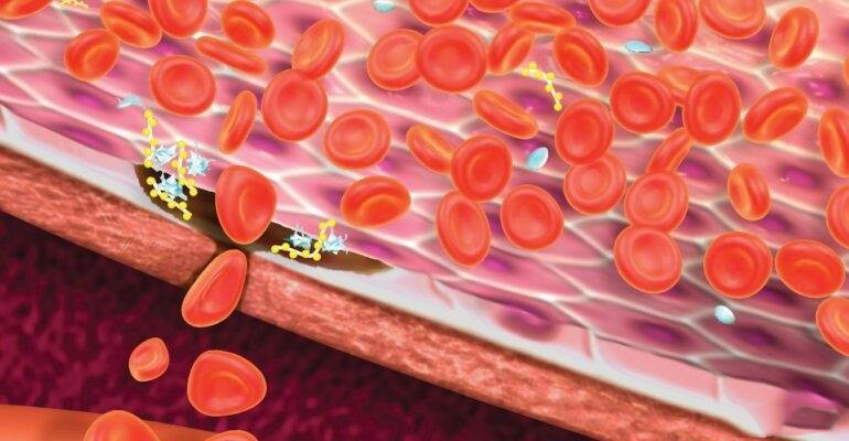 FDA扩大Wilate批准范围：用于血管性血友病的常规预防