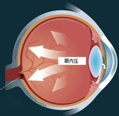 使用0.01%阿托品控制近视应该注意什么？为什么首选善瞳？_香港济民药业