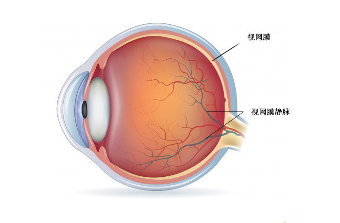 罗氏公布Vabysmo治疗视网膜静脉阻塞最新72周数据_香港济民药业