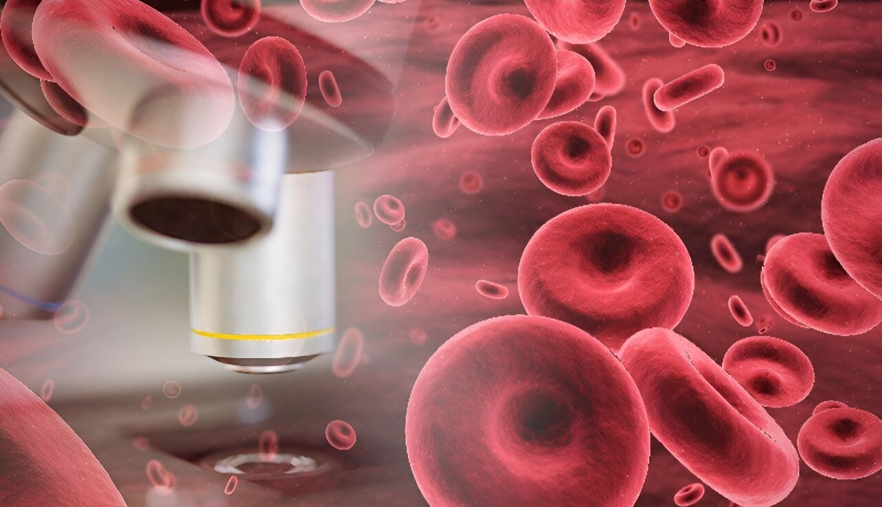 Iptacopan改善持续性贫血的血液学和临床结果