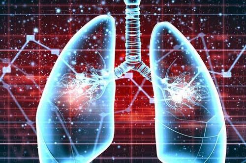首款！肺动脉高压固定剂量组合疗法Opsynvi获FDA批准_香港济民药业