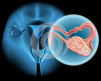 铂类耐药卵巢癌新型疗法Elahere获得FDA完全批准