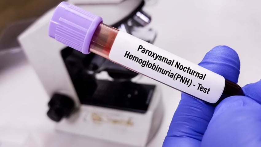 阿斯利康Voydeya获FDA批准，作为罕见病PNH血管外溶血的附加疗法_香港济民药业