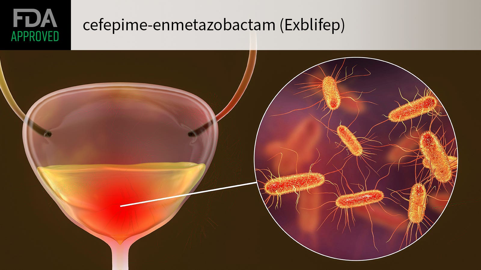 Exblifep（cefepime/enmetazobactam，头孢吡肟/恩美他唑巴坦）中文说明书-价格-适应症-不良反应及注意事项_香港济民药业