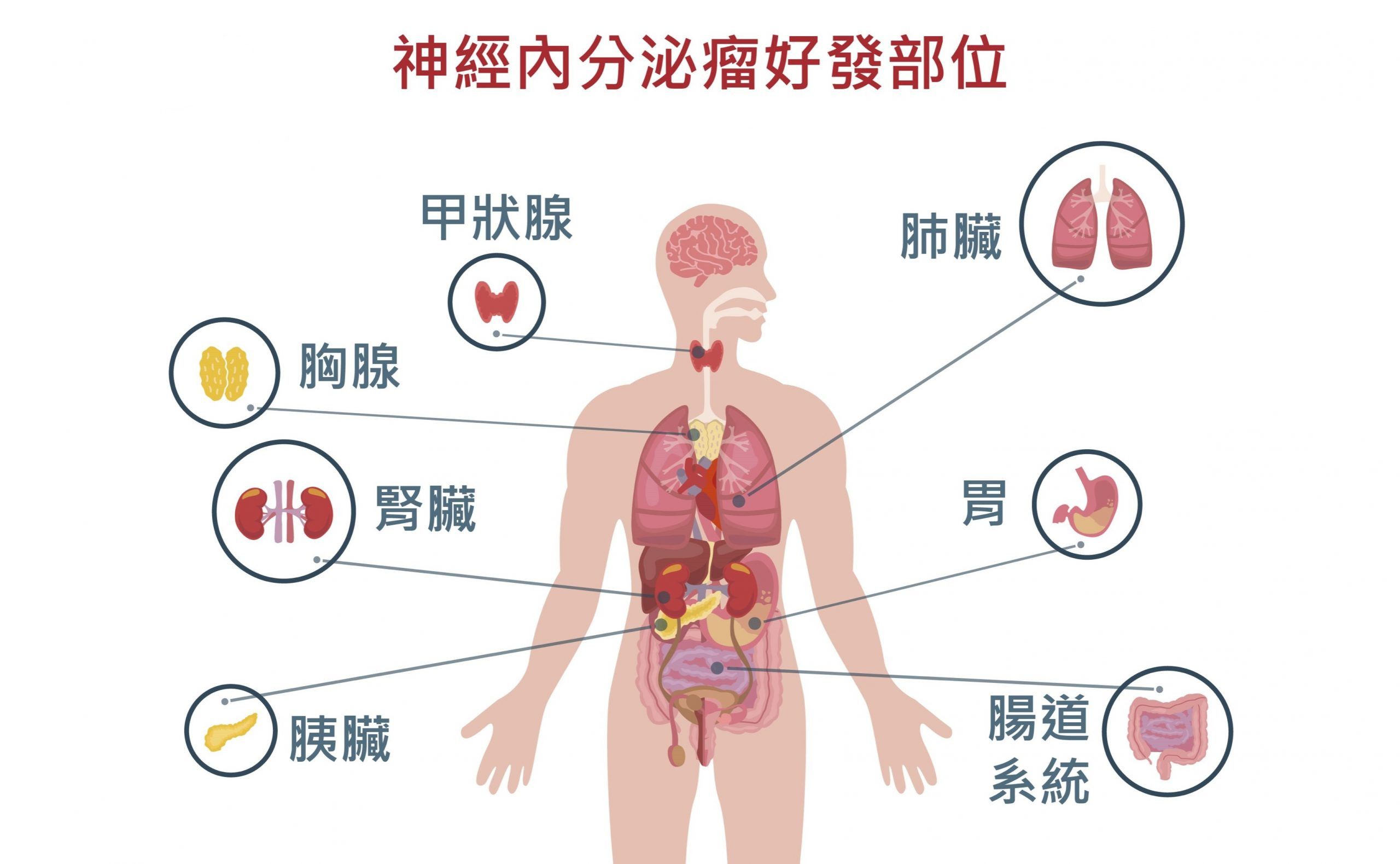 诺华放射配体疗法Lutathera扩大适用年龄至胃肠胰神经内分泌肿瘤的儿科患者_香港济民药业