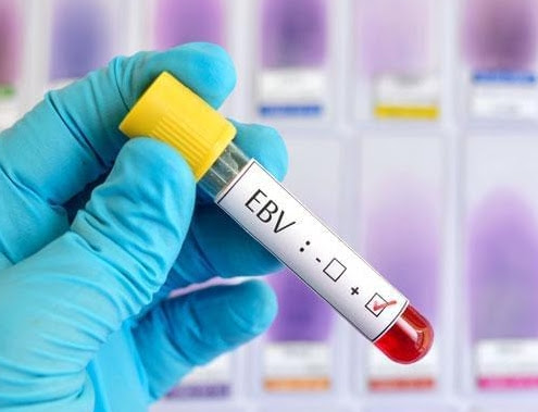 首款EBV阳性PTLD疗法有望获批！FDA授予tab-cel优先审评资格_香港济民药业
