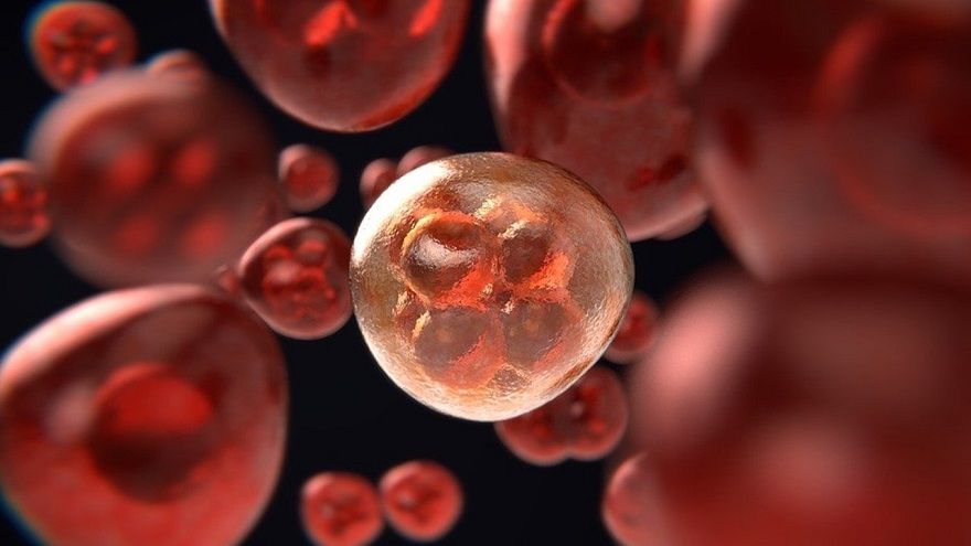新真实世界数据：Pepaxti对三类难治性多发性骨髓瘤患者有效