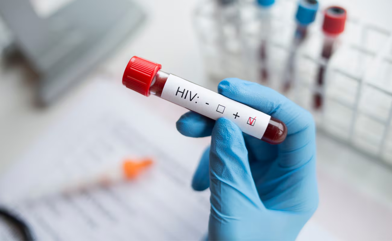 新型长效HIV预防药物Yeztugo获得FDA批准，每半年给药一次_香港济民药业