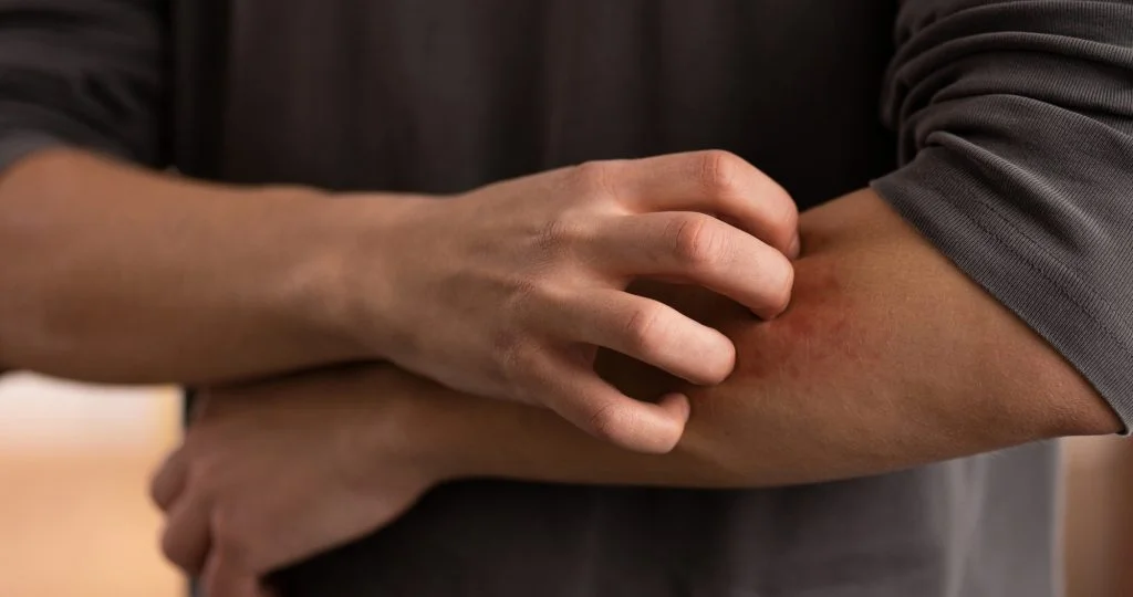 原发性胆汁性胆管炎新药Lynavoy获FDA批准