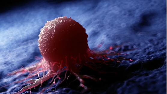 FDA批准Opdivo联合化疗用于治疗既往未接受过治疗的霍奇金淋巴瘤