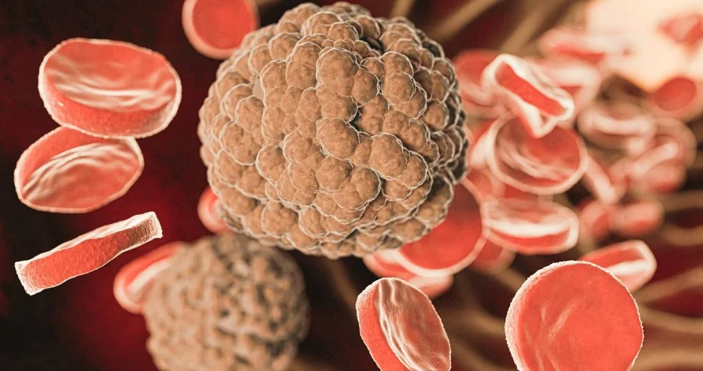 严重白细胞粘附缺陷症I型首个基因疗法Kresladi在美获加速批准