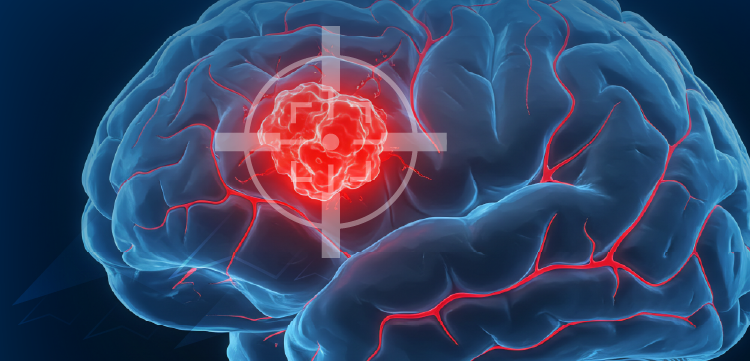 FDA批准Prolia生物类似药Ponlimsi上市，并接受Xolair生物类似药的审查_香港济民药业