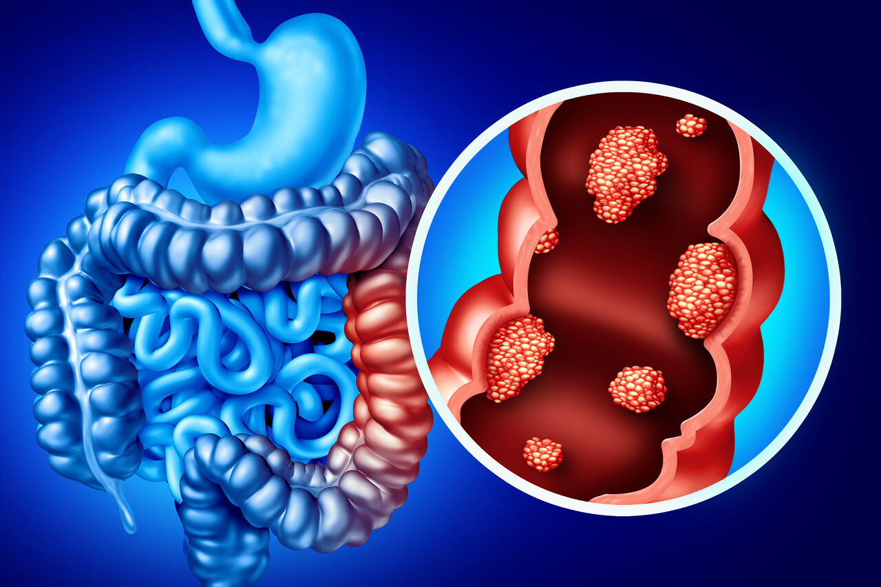 二线治疗FGFR2+胆管癌！Lirafugratinib获FDA授予优先审查资格