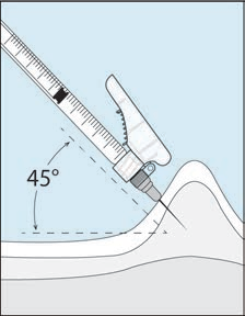 Hepcludex（Bulevirtide，布列韦肽）分步注射指南_香港济民药业